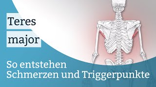 Teres major Schmerzen Triggerpunkte und deren Aktivierung [upl. by Nameerf]