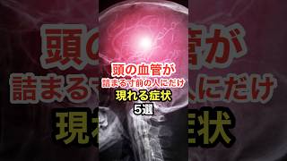 頭の血管が詰まる寸前の人にだけ現れる症状【5選】 長寿命 [upl. by Llezom]