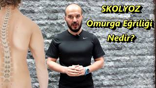 Skolyoz  Omurga Eğriliği Nedir [upl. by Dric]