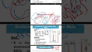 practical  ESR amp osmotic fragility test explaination [upl. by Anaud580]