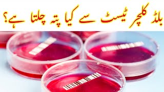 Blood Culture test se kiya pata chalta hai  بلڈ کلچر ٹیسٹ سے کیا پتہ چلتا ہے؟ [upl. by Akerdal21]