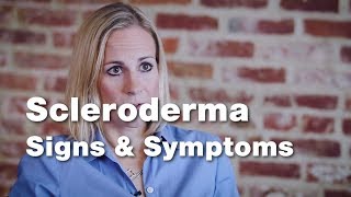 Signs and Symptoms of Scleroderma  Johns Hopkins [upl. by Aruat500]