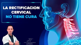 La Rectificación cervical 🦒 NO hay cura pero hay tratamiento [upl. by Ithnan21]