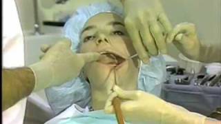 General Procedures in Oral Surgery [upl. by Molton]