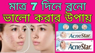 Acnestar Gel  Acnestar Gel Review Acnestar Gel side effects  Acnestar gel cream in bengali [upl. by Lazaro]