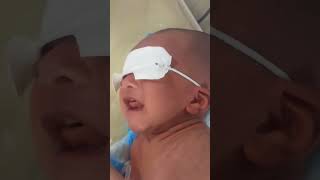 Caput succedaneum head baby newborn cute newbornbaby viralvideo babyboy [upl. by Accebor]