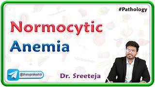 5 Normocytic Anemia  USMLE Step Pathology [upl. by Bernj228]