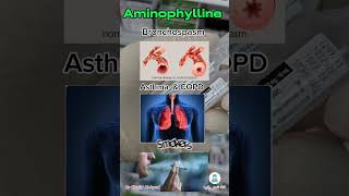 من صالة العمليات امينوفيلين Aminophylline [upl. by Grinnell]