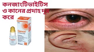 সিপ্রোসিন ড্রপের কাজ কি।Ciprocin eye drop। [upl. by Asfah]