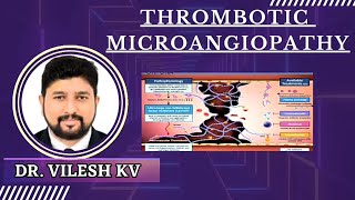 THROMBOTIC MICROANGIOPATHYTMA  DR VILESH K V [upl. by Saravat784]