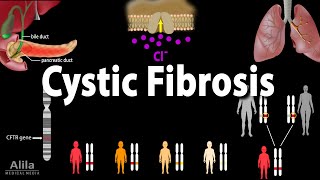 Cystic Fibrosis Pathophysiology Genetics Symptoms Diagnosis and Treatments Animation [upl. by Adnale311]