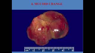 Reversible cell injury level 1 medicine 2024 [upl. by Jandel]