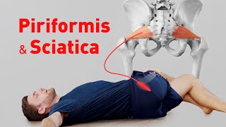 Piriformis Syndrome amp Sciatica  Stretching Exercises [upl. by Cantlon]