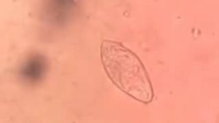 Schistosoma haematobium egg [upl. by Fawne419]