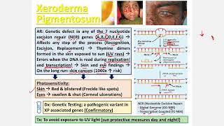 Xeroderma Pigmentosa CBL [upl. by Holms]