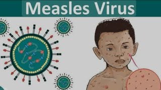 TOPICquot31MEASLES DISEASEamp ITS  DIAGNOSIS SYMPTOMS SIGNS PREVENTION COMPLICATIONS TREATMENT [upl. by Serge]