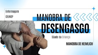 Manobra de Desengasgo  Manobra de Heimlich [upl. by Carolyn309]