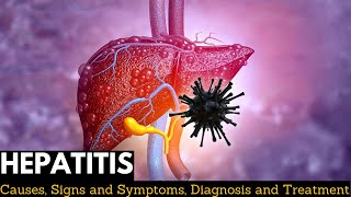 Hepatitis Causes Signs and Symptoms Diagnosis and Treatment [upl. by Brucie]