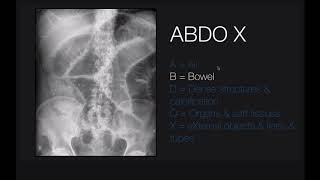 Abdominal xrays [upl. by Nomrac]