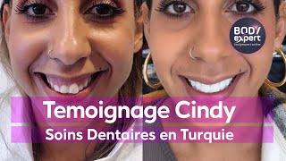 SOINS DENTAIRES  🦷 Témoignage de Cindy  20 facettes dentaires Emax  BODYEXPERT [upl. by Nagap832]