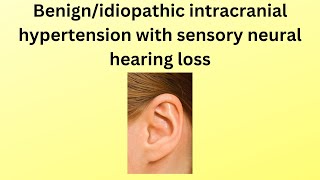 benign intracranial hypertension with hearing loss a rare case [upl. by Orpheus]