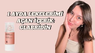 LEKELERİMİ AÇAN İÇERİK GLABRİDİN NEDİR [upl. by Ateloj]