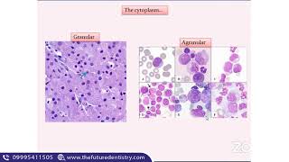 Odontogenic cysts and Histology of radicular cyst  NEET MDS  Oral pathology [upl. by Eiramlatsyrk]