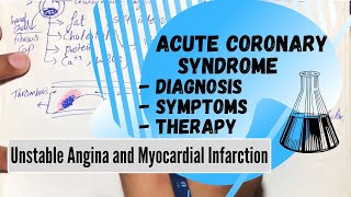 ACUTE CORONARY SYNDROME  Diagnosis Symptoms Therapy Unstable Angina and Myocardial Infarction [upl. by Aenaj984]