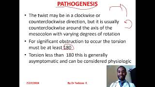 Volvulussigmoidcecaltransverse colonsplenic flexture part I by dr Tadesse fenta [upl. by Uni681]