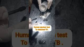 TB under microscope shorts viral microscope india [upl. by Cordy]