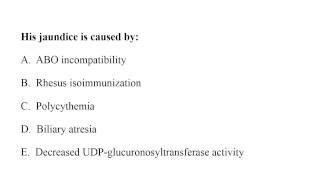 Neonatology MCQ 121 jaundice [upl. by Teuton]