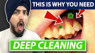 Teeth Cleaning vs Deep Cleaning  Dentist Explains How Teeth Are Cleaned [upl. by Sallad]