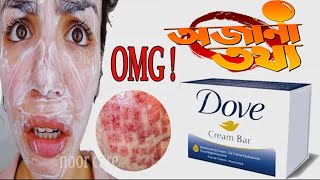 The Truth About Dove Bar Soap  dove soap review  noor care [upl. by Oz669]