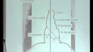 PA Akciğer GrafisindeTelegrafi Kalp Anatomisi  TIP  TUS VİDEO [upl. by Ilwain]