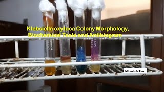 Klebsiella oxytoca colony morphology and Biochemical Tests [upl. by Nnaid10]