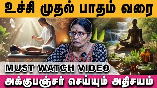 Accupuncture Medicine  ல இவ்வளவு நன்மைகளா   Parimalar Selvi [upl. by Enetsirk237]