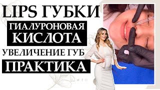 Lips Губки Гиалуроновая кислота для увеличение губ Практика [upl. by Eirelam]