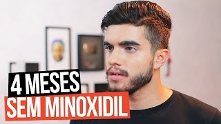 4 MESES SEM MINOXIDIL  BARBA CAI EFEITOS COLATERAIS [upl. by Eanram]