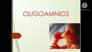 Polihidramnios y Oligoamnios [upl. by Llecrup]