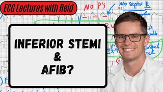 AFib  STEMI  Day 25 ECG Challenge [upl. by Aititil]