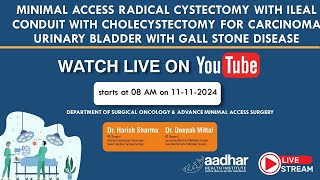 MINIMAL ACCESS RADICAL CYSTECTOMY WITH ILEAL CONDUIT amp CHOLECYSTECTOMY [upl. by Adnamra477]