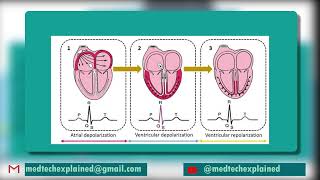 ECG FAST TRACK part 16 Normal sinus rhythm [upl. by Idnim]