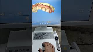 scanner intra oral sirona cerec dentist cad laboratorio scanner sirona [upl. by Learsi]