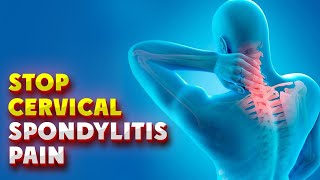 5 Cervical Spondylitis Exercises for Quick Relief [upl. by Christianna65]