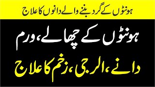 Mouth Blisters Causes and Treatment In Urdu  Honton Ke Chalo Ka ilaj  Honton ke dena ka ilaj [upl. by Ivanah]