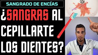 ¿Sangras al CEPILLARTE ENCÍAS SANGRANTES  6 Causas del SANGRADO DE ENCÍAS [upl. by Trebleht]