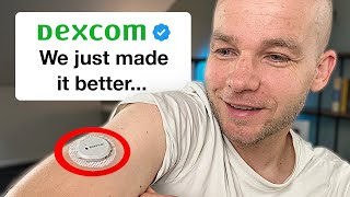 Dexcom G7 Major Upgrades Revealed – Don’t Miss Out [upl. by Anitnamaid]