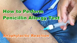 Penicillin G Allergy Test  Benzylpenicillin  Type 1 Hypersensitivity Reaction  How to Do [upl. by Ylevol]