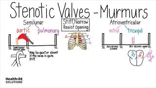 Heart murmur sounds cardiac auscultation sounds  UKMLA  CPSA [upl. by Tiphanie]