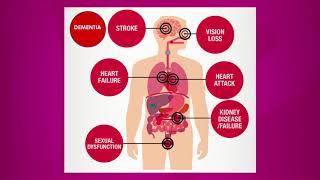 Causes of High Blood Pressure [upl. by Niran261]